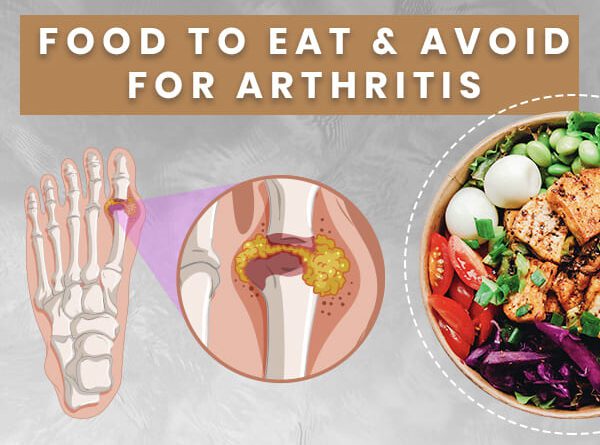 AVOID AND PREVENT ARTHRITIS