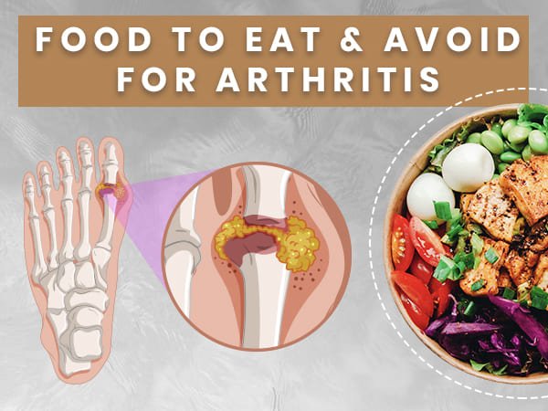 AVOID AND PREVENT ARTHRITIS