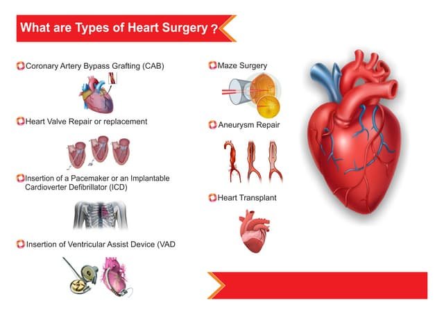 Types of Heart Surgery